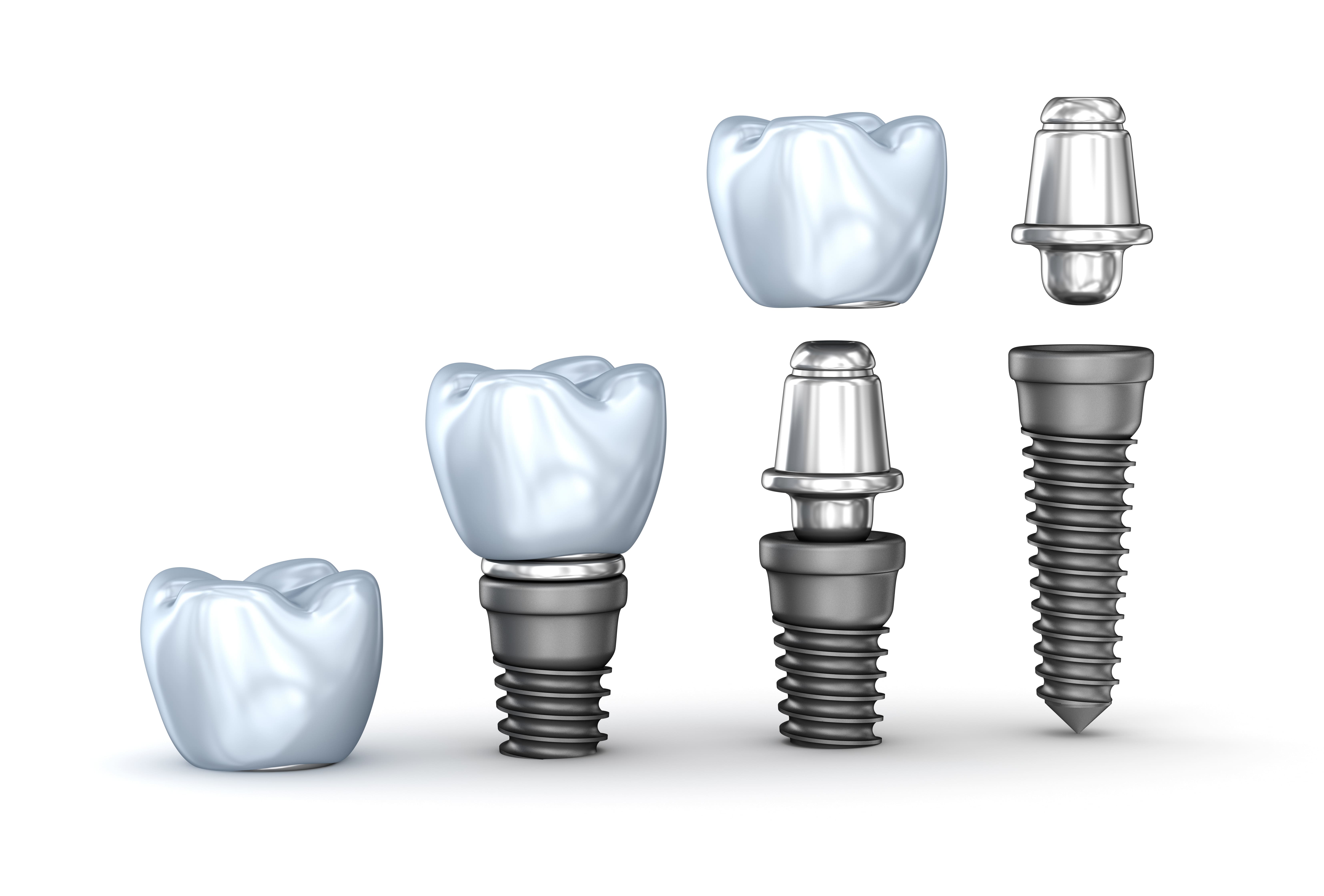 синус-лифтингу синус-лифтингу