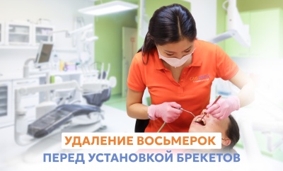 Удаление восьмерок перед установкой брекетов